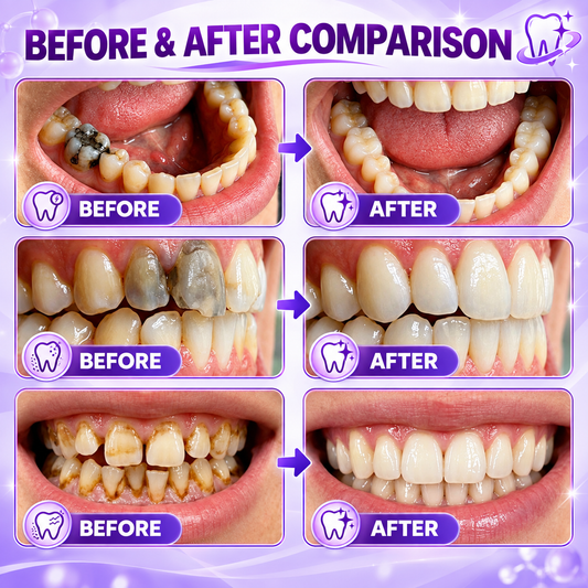 TERVENCE® Cavity-Repair Natural Enamel Filling Gel — image 2