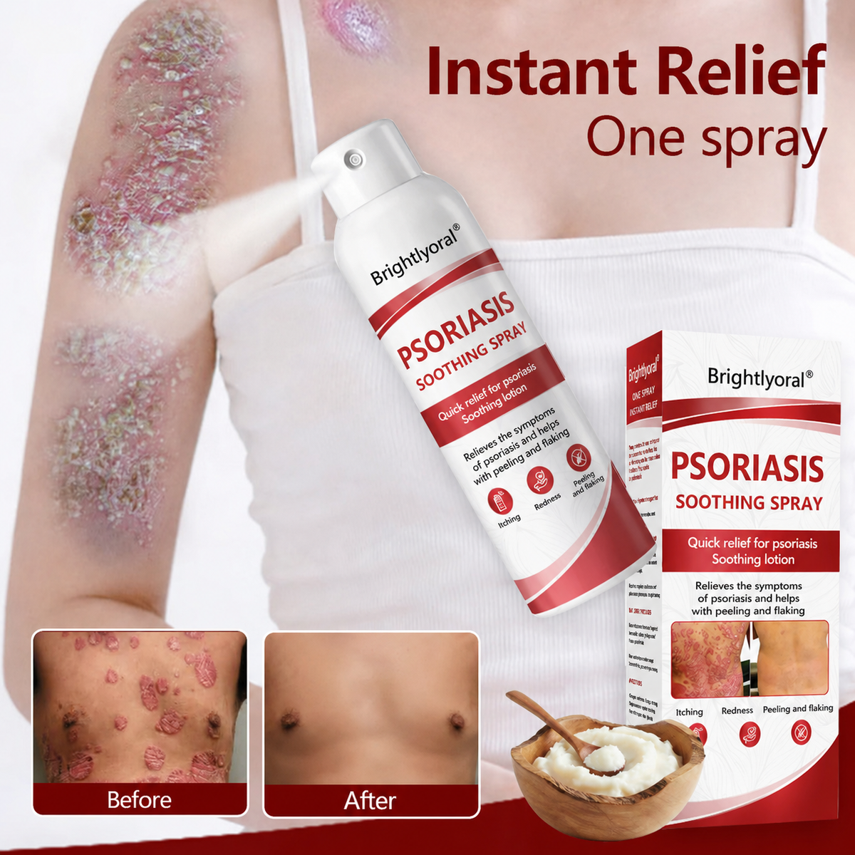 🔴Brightlyoral® Beef Tallow Spray for itchy—flaking skin associated with psoriasis🐓 — image 2