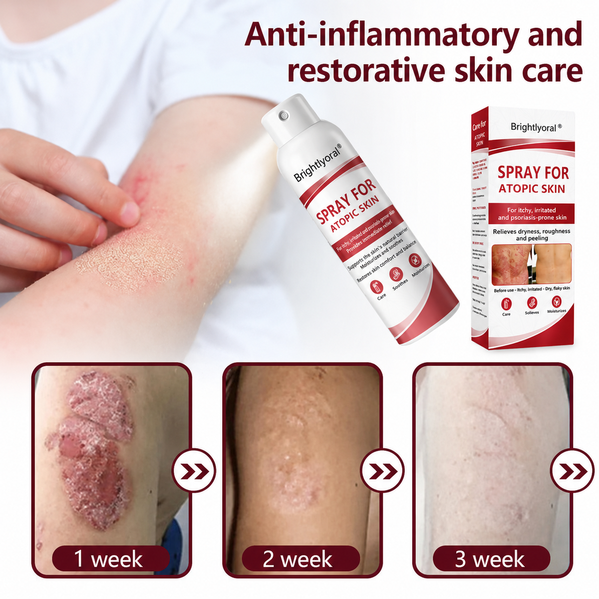 🔴Brightlyoral® Beef Tallow Spray for itchy—flaking skin associated with psoriasis🐓 — image 6