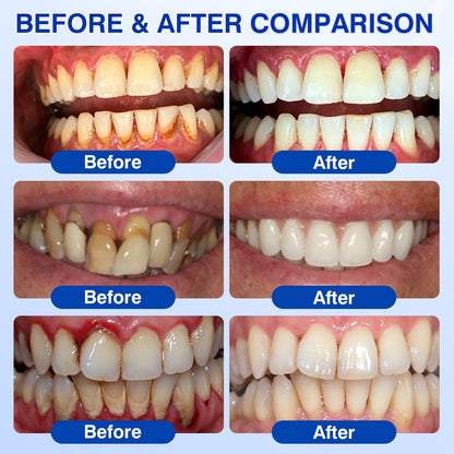 👨 ⚕️🦷🛡️BBOJI®GumRevive Periodontal Repair Gel — image 4