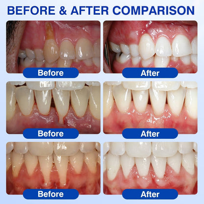 👨 ⚕️🦷🛡️BBOJI®GumRevive Periodontal Repair Gel — image 3