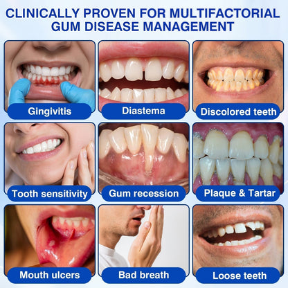 👨 ⚕️🦷🛡️BBOJI®GumRevive Periodontal Repair Gel — image 6