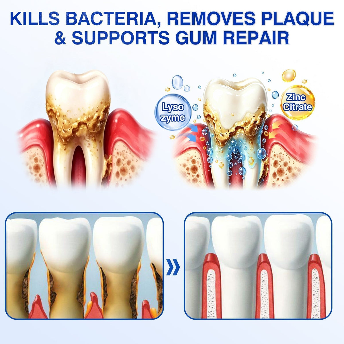 👨 ⚕️🦷🛡️BBOJI®GumRevive Periodontal Repair Gel — image 7