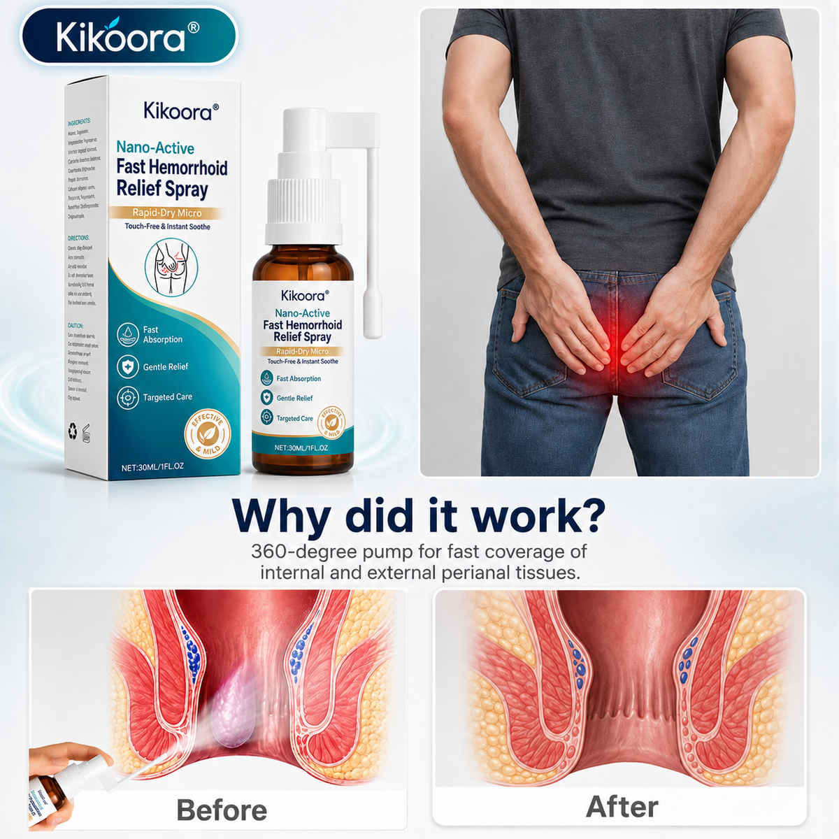 🌿👨 ⚕️Kikoora® Nano-Active Fast Hemorrhoid Relief Spray | Rapid-Dry Micro-Mist with Essential Oils, Touch-Free & Instant Sooth — image 2