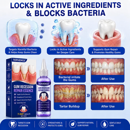 TERVENCE® 🏆GumRevive Periodontal Care Gel — image 10