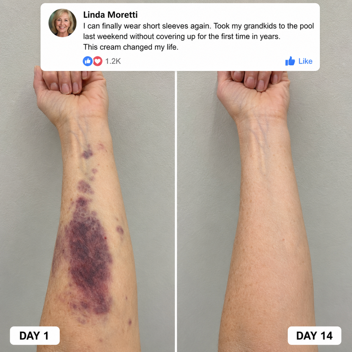TervenceTM Bruise Repair & Skin — Strengthening Cream — image 2
