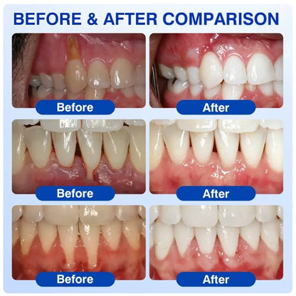 TERVENCE® 🏆GumRevive Periodontal Care Gel — image 3