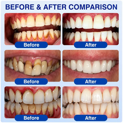 TERVENCE® 🏆GumRevive Periodontal Care Gel — image 4