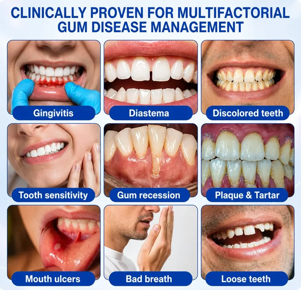 TERVENCE® 🏆GumRevive Periodontal Care Gel — image 6