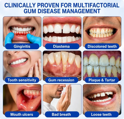 TERVENCE® 🏆GumRevive Periodontal Care Gel — image 6