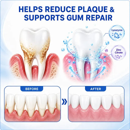 TERVENCE® 🏆GumRevive Periodontal Care Gel — image 7