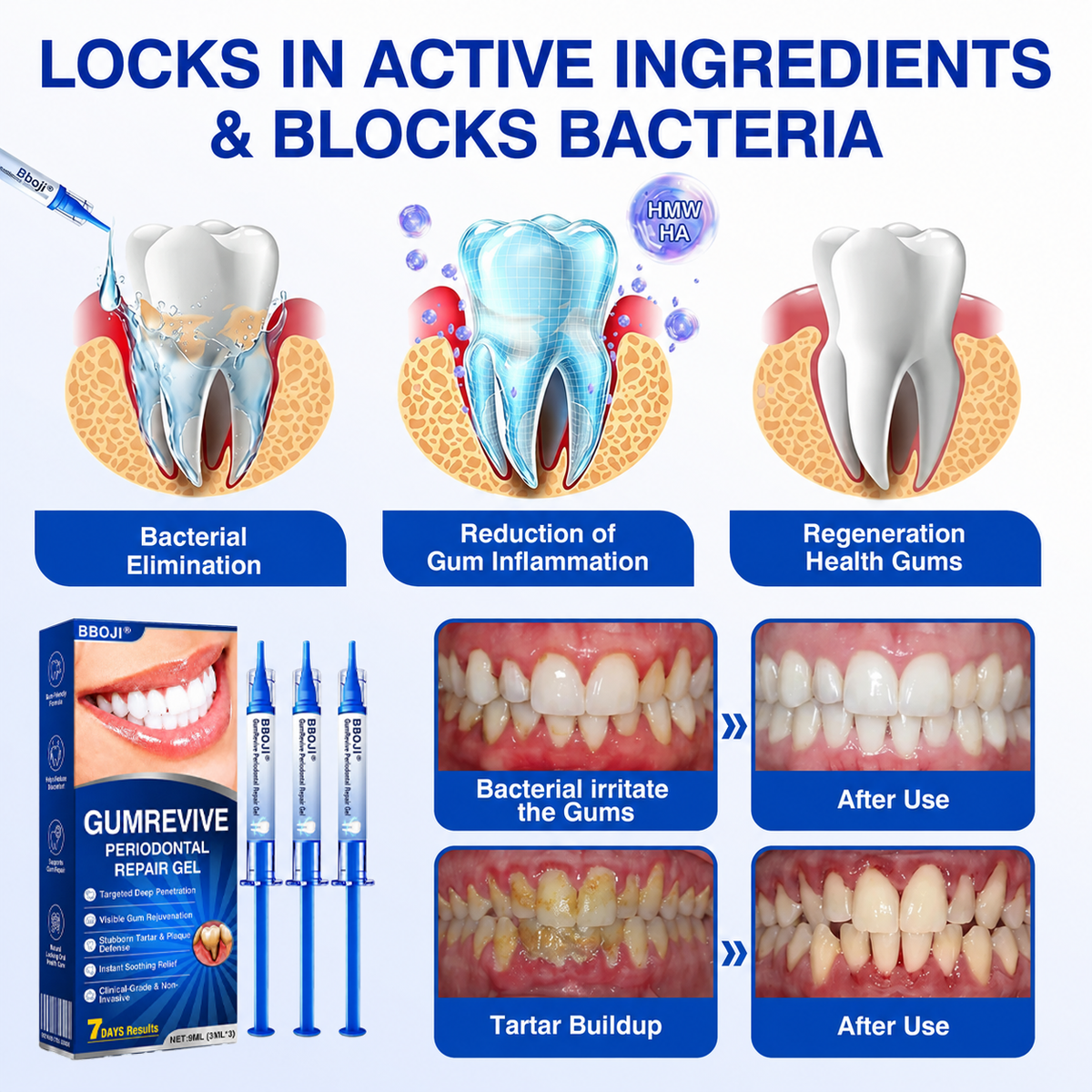👨 ⚕️🦷🛡️BBOJI®GumRevive Periodontal Repair Gel — image 9