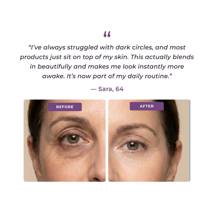 EyeCorrect+ Undereye Brightener(+ FREE Undereye Precision Brush) — image 2