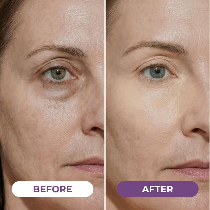 EyeCorrect+ Undereye Brightener(+ FREE Undereye Precision Brush) — image 3
