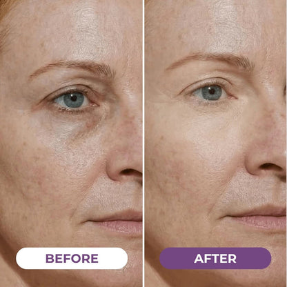 EyeCorrect+ Undereye Brightener(+ FREE Undereye Precision Brush) — image 4